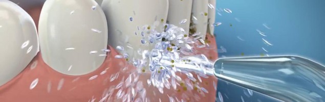 Ирригатор для пациентов с ограниченными физическими возможностями